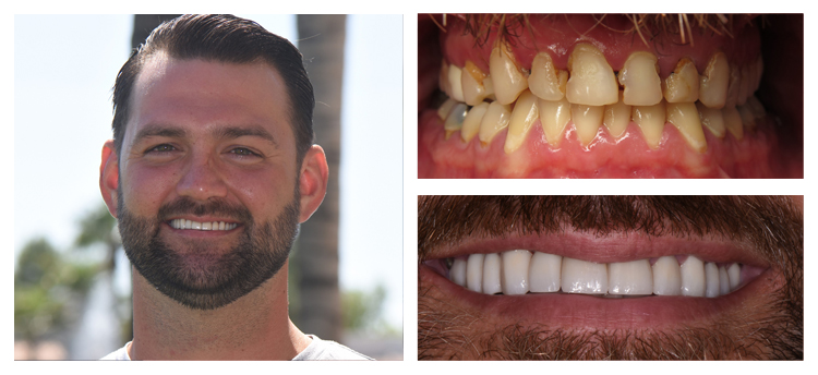 Dentist Chandler AZ Before and After