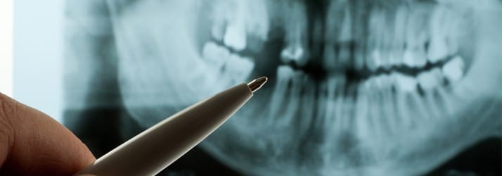 Dentist Chandler AZ Mouth X-Ray Pointing