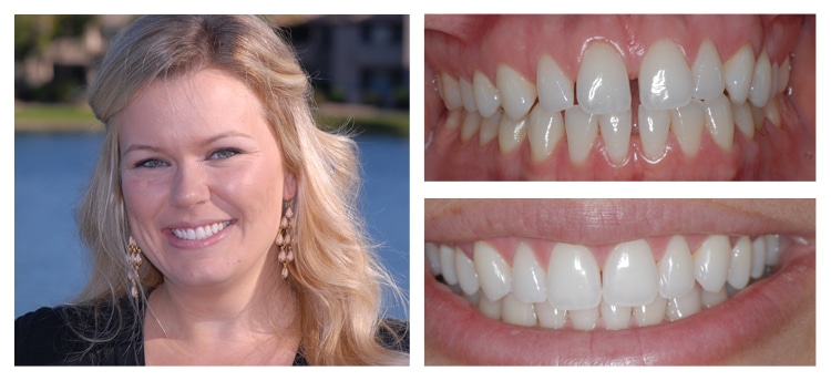 Dentist Chandler AZ Smile Gallery 1