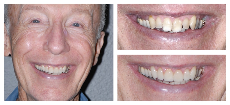 Dentist Chandler AZ Smile Gallery 17