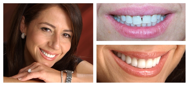 Dentist Chandler AZ Smile Gallery